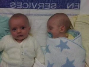 Pyloric Stenosis; the weight gain was different in my twins...
